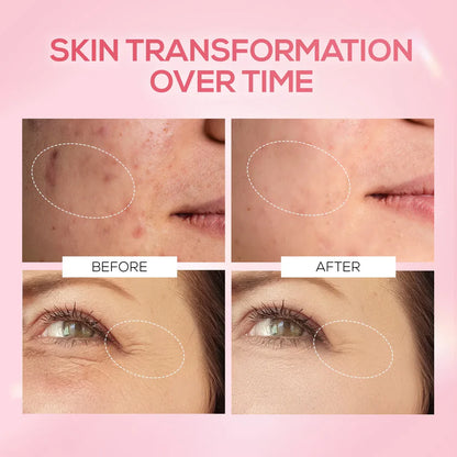 RENEE Pink Therapy PDRN Pink Peptide Serum For Hydrated & Radiant Skin, 30 ml